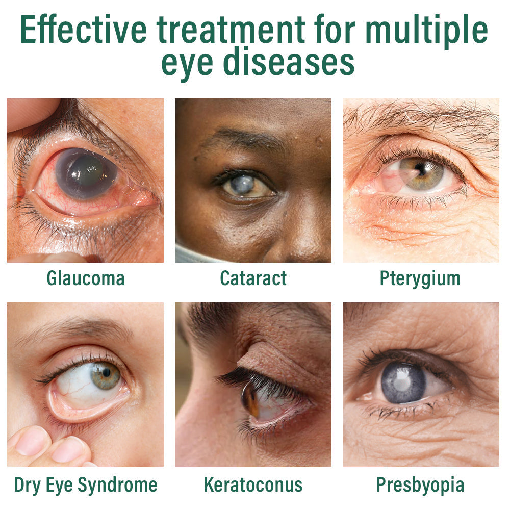 👩⚕️Seurico™ Nano Eye Drops Serum ✅FDA Approved(Suitable for presbyopia, dry eye syndrome, glaucoma, and cataracts) 🌻