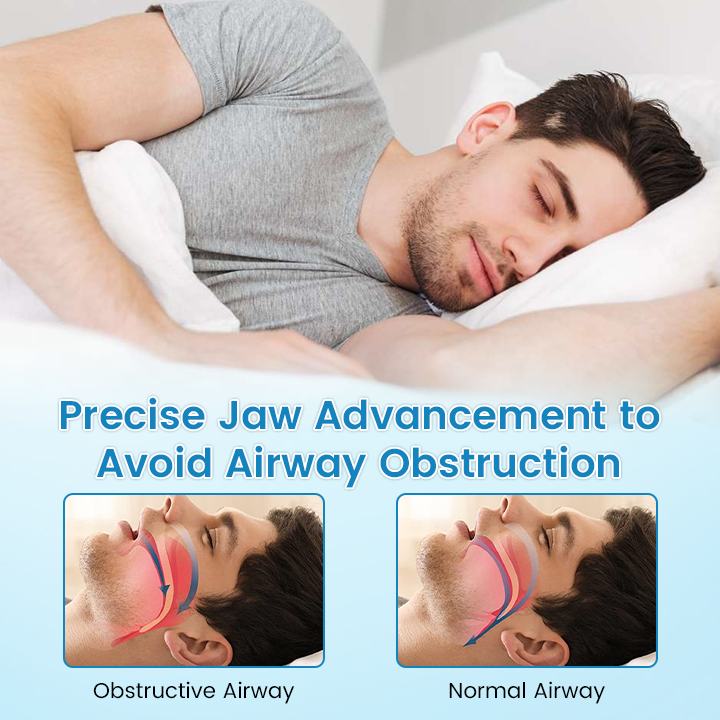 ✨Negusy™ Anti-Snoring & Anti-Grinding Teeth Protector