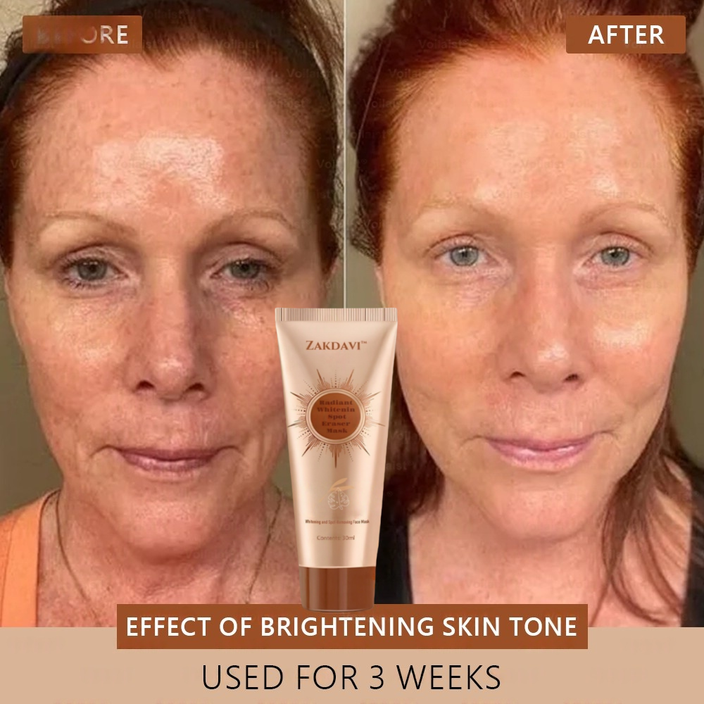 šµļø Zakdavi⢠Radiant Whitening & Spot Eraser MaskāØ| For Face and Body - Formulated with natural ingredients to permanently eliminate age spots, freckles, sun spots, and liver spots.