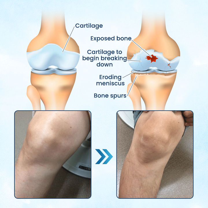 Negusy™ Joint Revive Hyaluronic Repair Cream