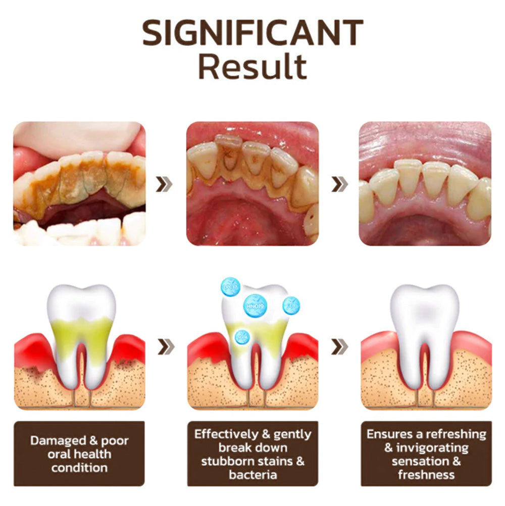 🦷 Seurico™ Niacinamide Whitening Toothpaste - Gentle on Gums, Designed for Sensitive Teeth, Reveals a Radiant, Healthy Smile