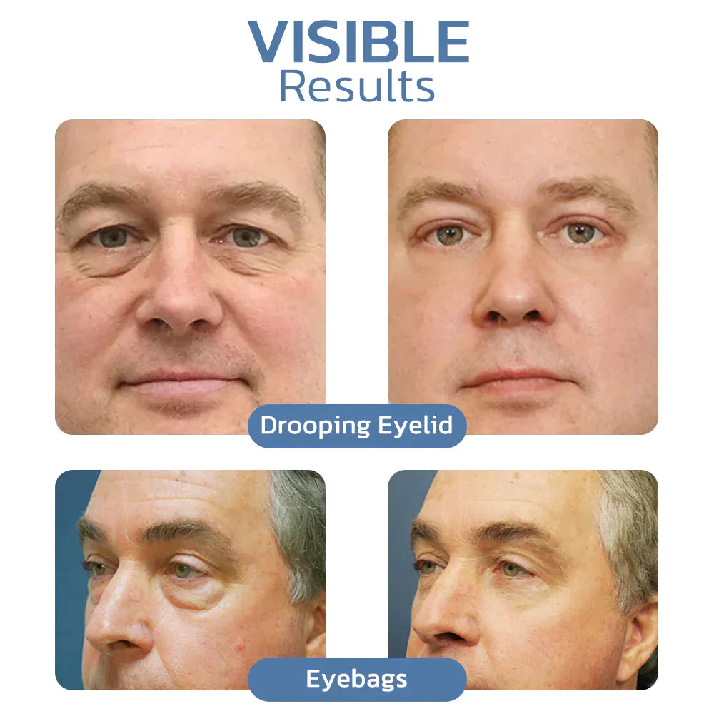 Odeiun™ Awaken Peptide Lifting Eye Gel