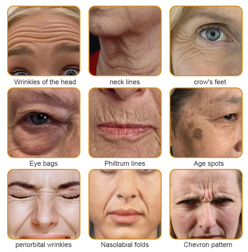 Negusy™ Botox-Infused Bee Venom Anti-Wrinkle Cream