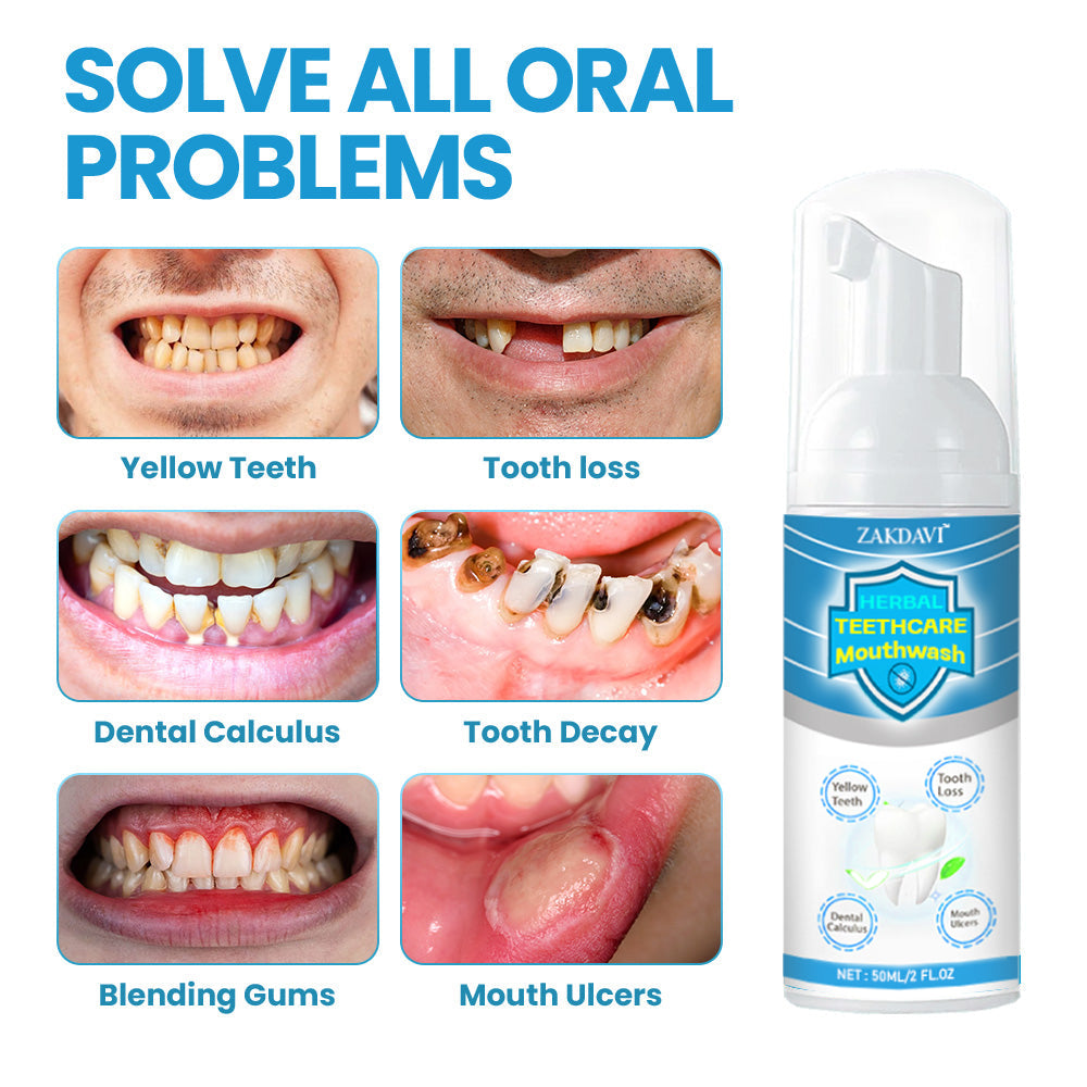 Zakdavi™ Herbal TeethCare Mouthwash - Target Multiple Oral Problems