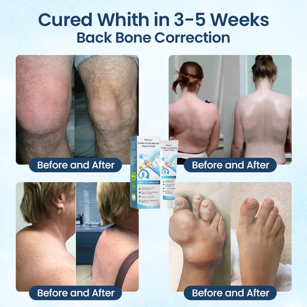 Negusy™ Joint Revive Hyaluronic Repair Cream
