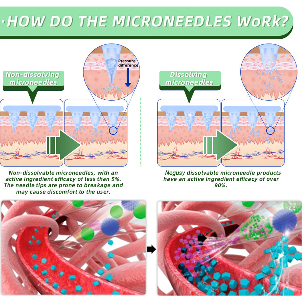 Negusy™ SMGT-GLP-1 Nano Microneedle Patch | Pain-Free, Long-Lasting Patch for Blood Sugar Control, Weight Loss & Cardiovascular Health