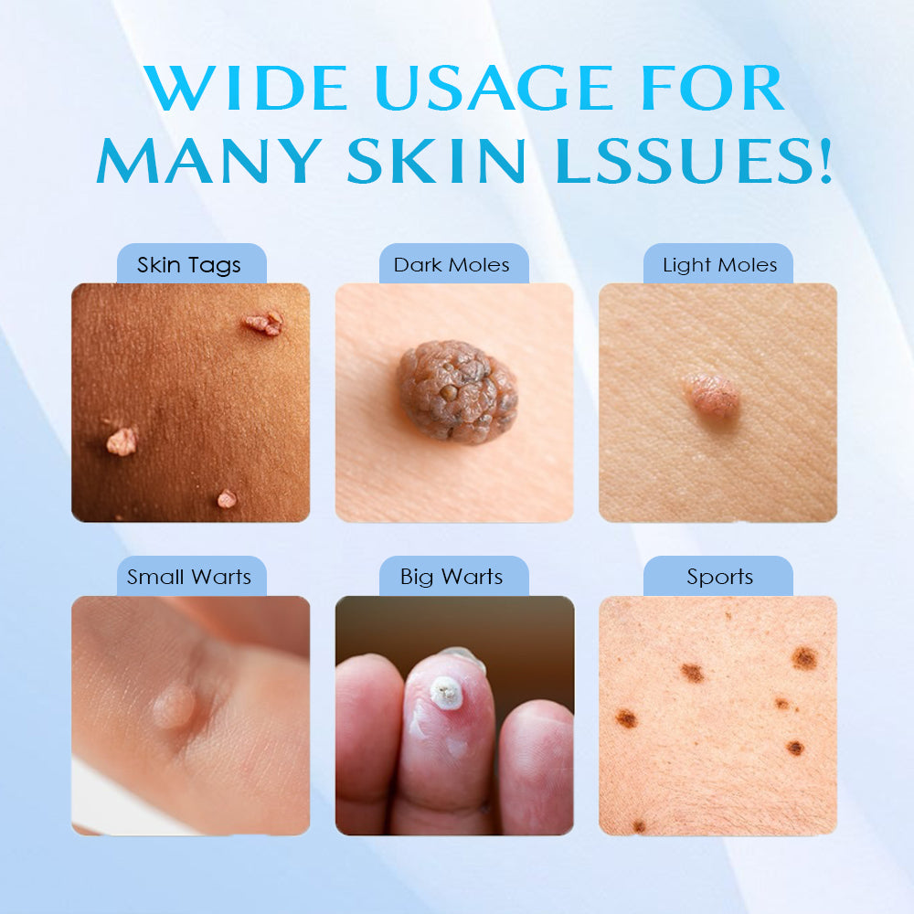 Seurico™ At-home Skin Tag Removal Pen