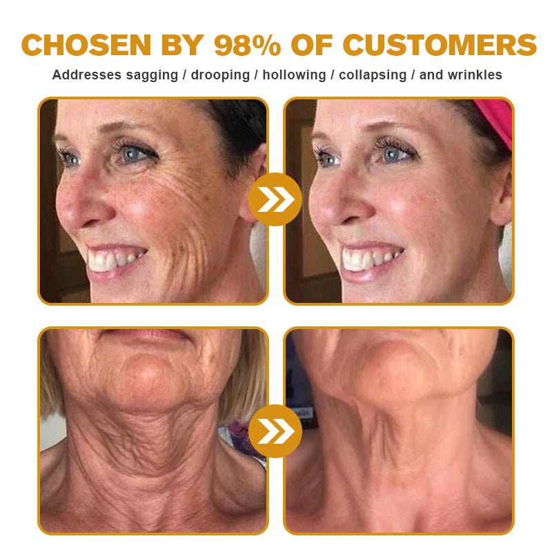 Negusy™ Botox-Infused Bee Venom Anti-Wrinkle Cream