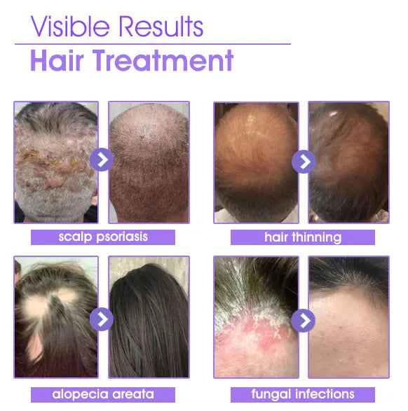 Odeiun™ ✨👩‍🔬 Odeiun™ Hair Root Repair Growth Drops – Fast Hair Growth, Repair Damaged Follicles, Restore Thick and Healthy Hair⚡