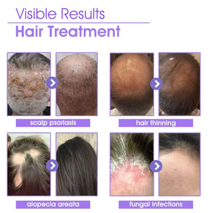 Odeiun™ ✨👩‍🔬 Odeiun™ Hair Root Repair Growth Drops – Fast Hair Growth, Repair Damaged Follicles, Restore Thick and Healthy Hair⚡