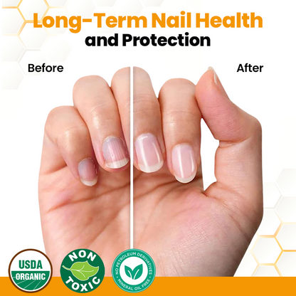 Seurico™ BeeVenom Anti-Fungal Nail Renewal Oil