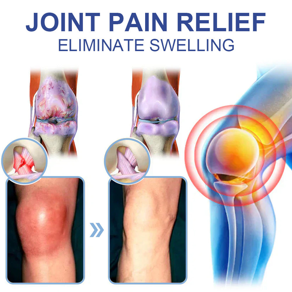 ✅HSE Approved: Seurico™ Magnesium Pain Healing Bone Cream ( Relief of neuropathy, muscle spasms, chronic pain, twitches or cramps, poor bone health and other arthritis)