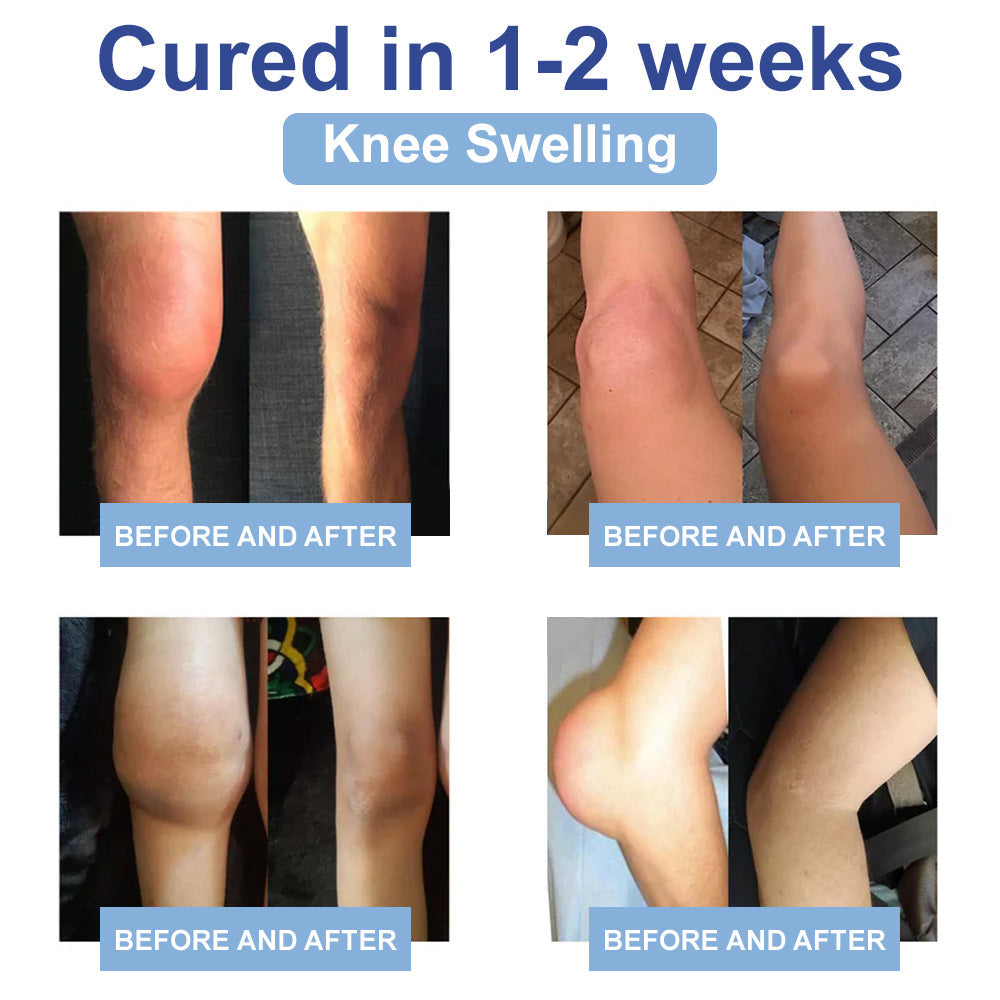 ✅HSE Approved: Seurico™ Magnesium Pain Healing Bone Cream ( Relief of neuropathy, muscle spasms, chronic pain, twitches or cramps, poor bone health and other arthritis)