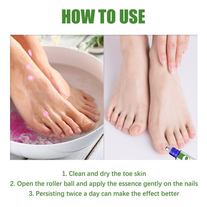 🔥Seurico™ Fungal Inhibiting Stick |Say Goodbye to Nail Fungus in Just 5 Days!