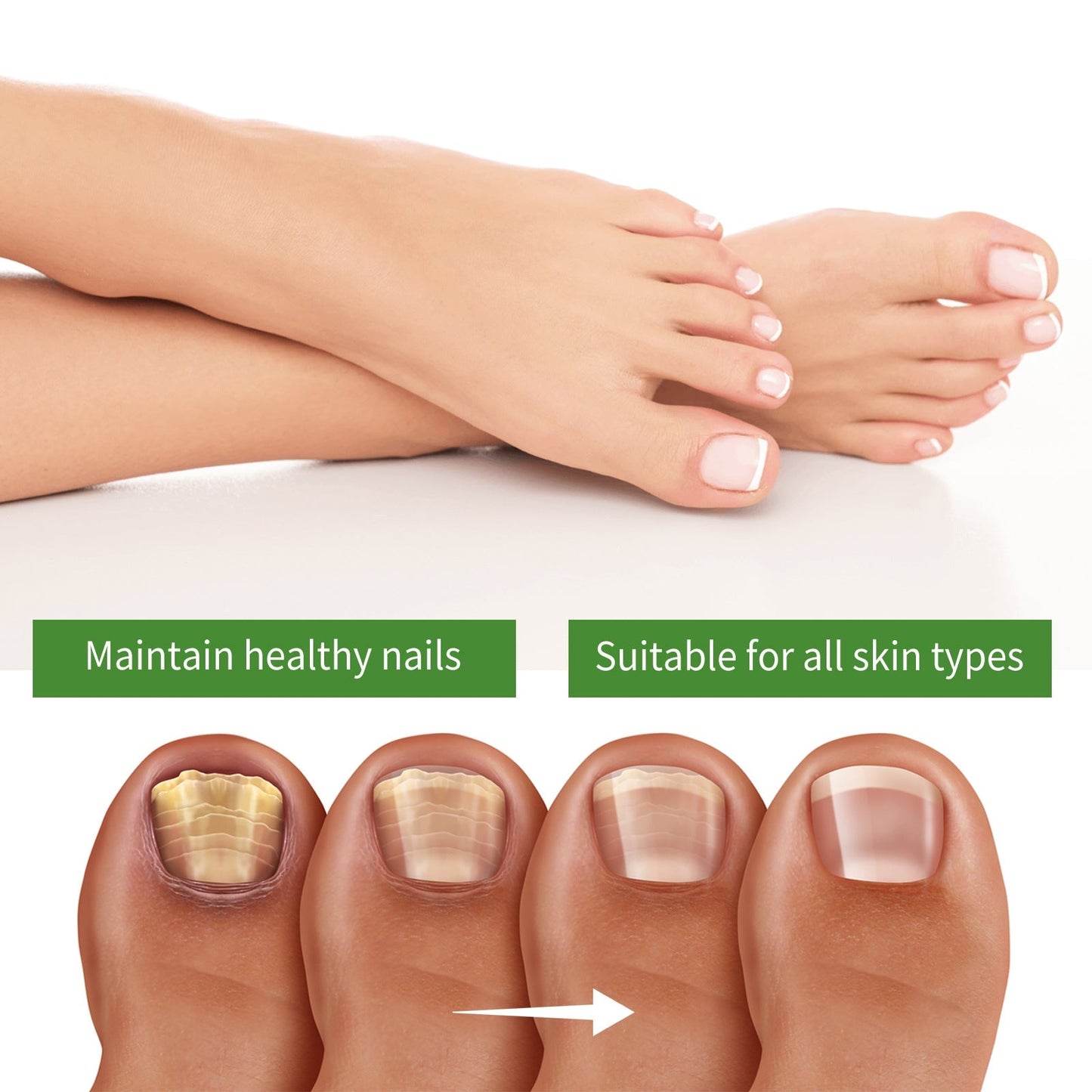 🔥Seurico™ Fungal Inhibiting Stick |Say Goodbye to Nail Fungus in Just 5 Days!