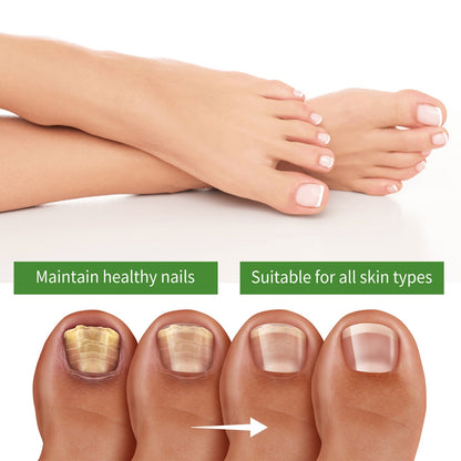 🔥Seurico™ Fungal Inhibiting Stick |Say Goodbye to Nail Fungus in Just 5 Days!