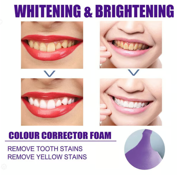 Seurico Herbal Whitening Mousse Toothpaste
