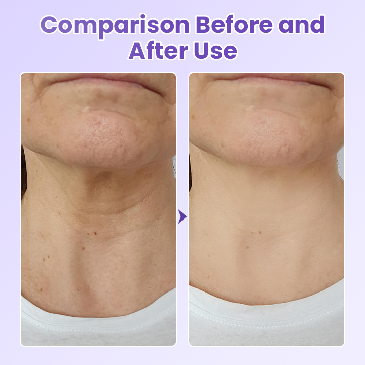 Negusy™ NeckYouth Peptide Anti-Wrinkle Patch