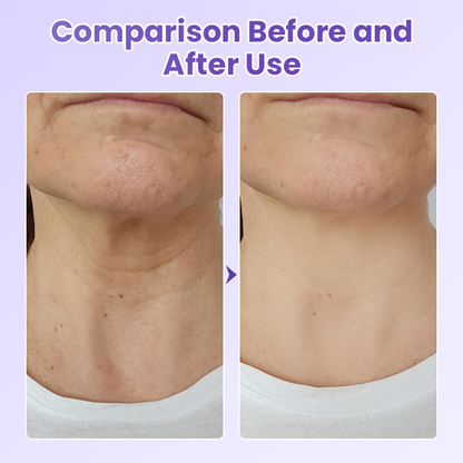 Negusy™ NeckYouth Peptide Anti-Wrinkle Patch