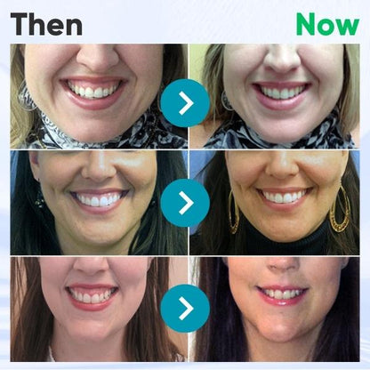 ODEIUN™ Gum Therapy Gel — The Trusted Solution for Gum Recession Repair