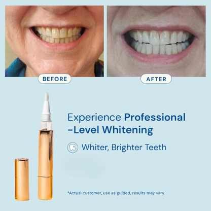 Seurico™ Whitening Pen