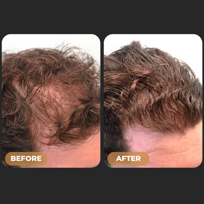 ODALIT™ Root Activator Shampoo - Increased Hair Growth with Just 4 Washes a Week