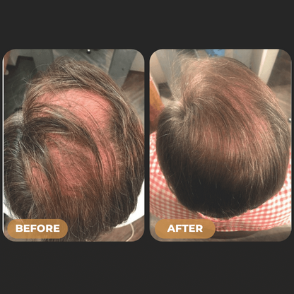 ODALIT™ Root Activator Shampoo - Increased Hair Growth with Just 4 Washes a Week