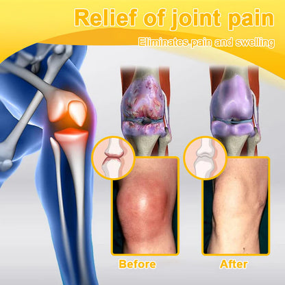 🎁Flash Sale - Odeiun™ Botulinum Toxin & Bee Venom Pain-Relief Bone Healing Cream