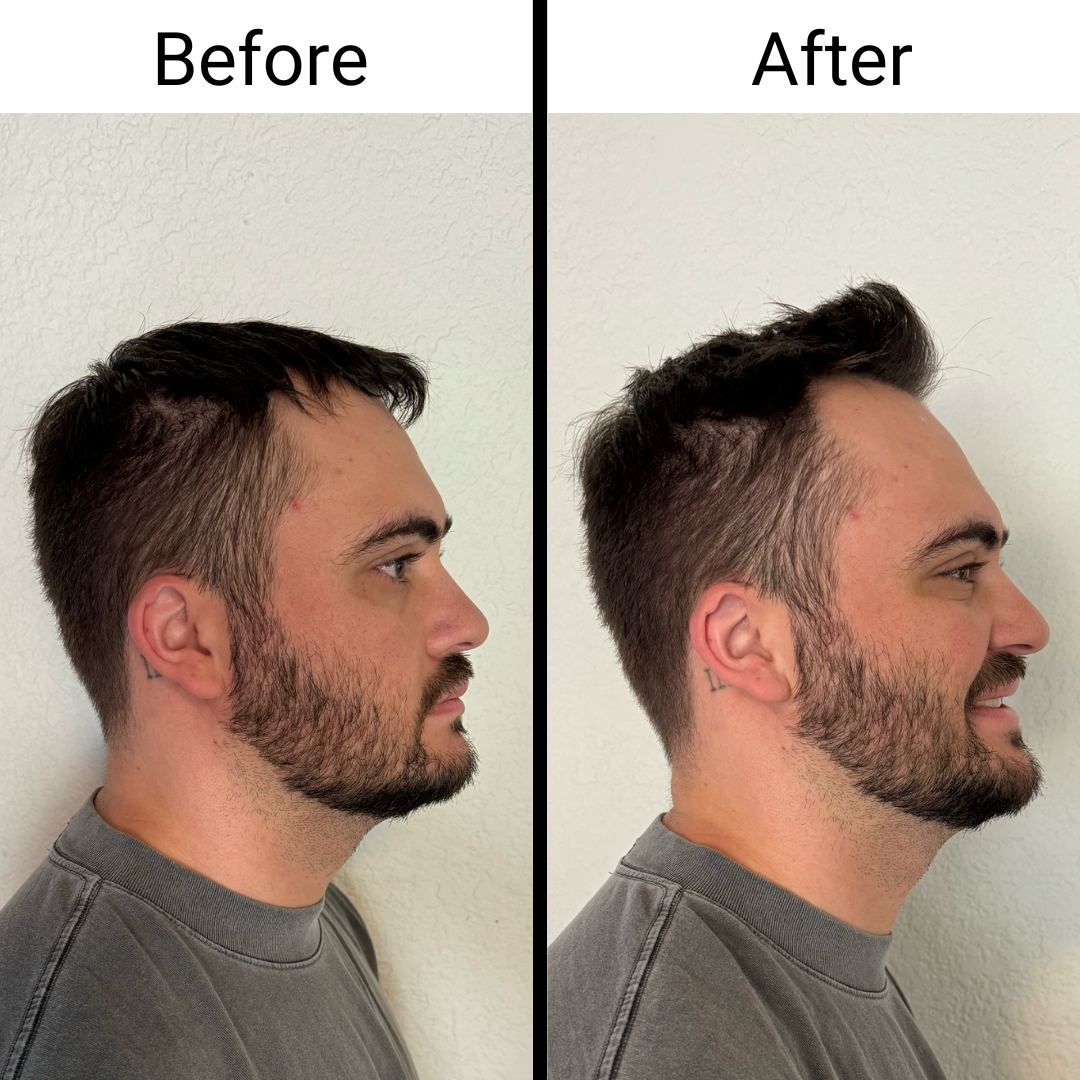 Negusy™ Hair Styling Powder – Instant volume, lasting confidence!