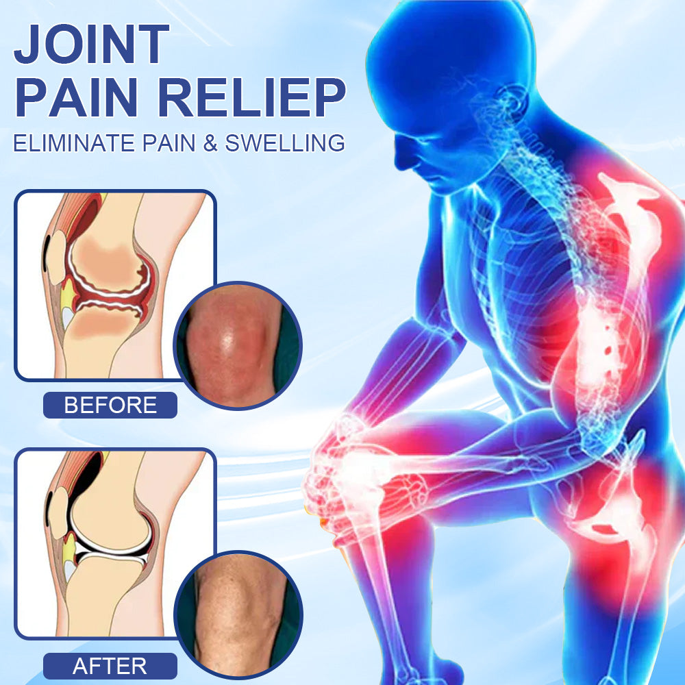 ✅HSE Approved: Seurico™ Magnesium Pain Healing Bone Cream ( Relief of neuropathy, muscle spasms, chronic pain, twitches or cramps, poor bone health and other arthritis)