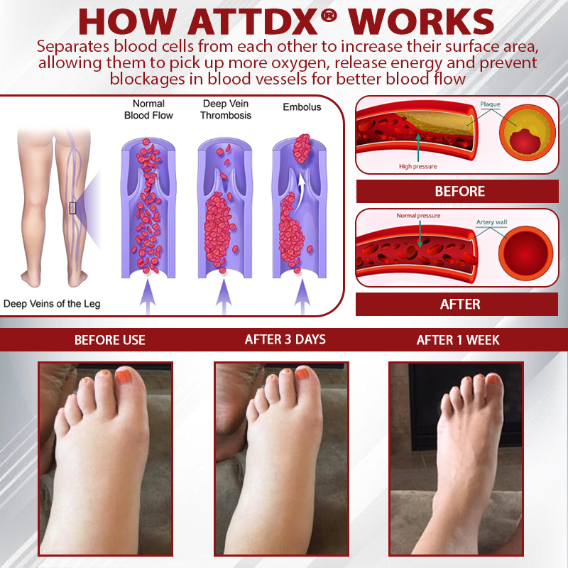 ODEIUN™ Advanced CVI Edema Therapy Cream