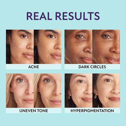 Negusy™ All-in-One Perfecting Tint | Foundation + Concealer + Self-Tanner in One — Your All-Over Complexion in a Single Bottle!