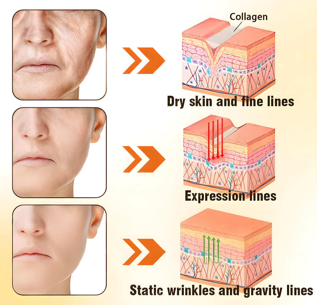 ✅ Official Store | ODEIUN™ Anti-Aging Moisturizing Cream 💧 Hyaluronic Acid + Retinol + Collagen – Youthful Glow for Face, Neck, Chest & Legs ✨ Day & Night Care