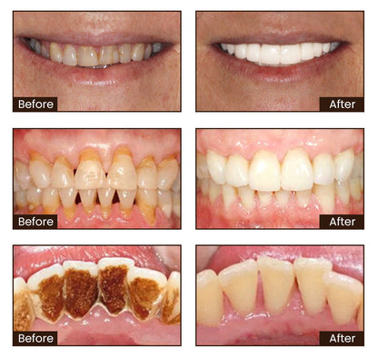 🦷 Seurico™ Niacinamide Whitening Toothpaste - Gentle on Gums, Designed for Sensitive Teeth, Reveals a Radiant, Healthy Smile