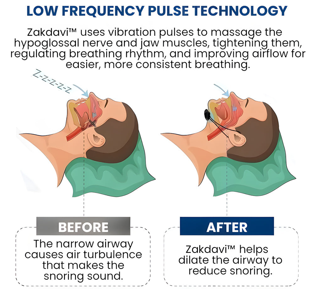Zakdavi™ MetaboGuard Snore Relief for CardioHealth