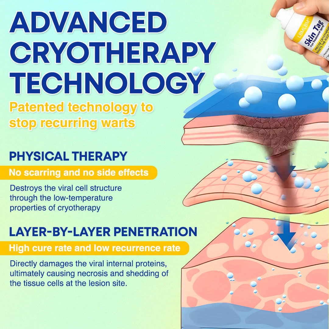 ❄️ LBMLBM™ Skin Tag Cryo Treatment Spray — Fast Freezing At-Home Removal ✨