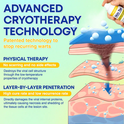 ❄️ LBMLBM™ Skin Tag Cryo Treatment Spray — Fast Freezing At-Home Removal ✨