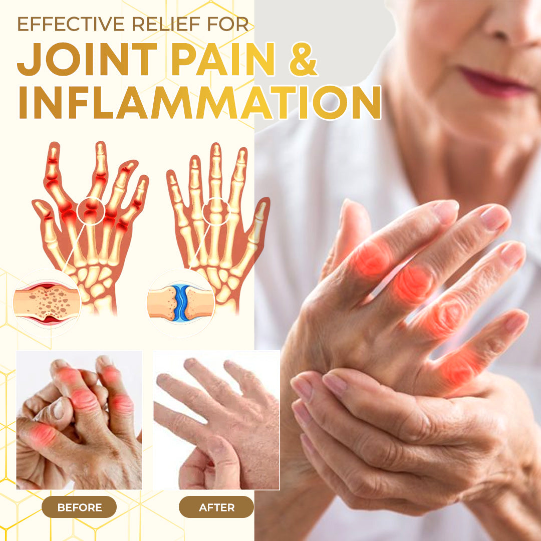 Seurico™ Bee Venom Joint Therapy Pain Relief Gel 🐝🔥