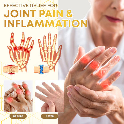 Seurico™ Bee Venom Joint Therapy Pain Relief Gel 🐝🔥