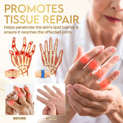 Odeiun™ Orthopedic Cream | AAOS-Inspired Pain Relief & Bone Support with Bee Venom + Botulinum