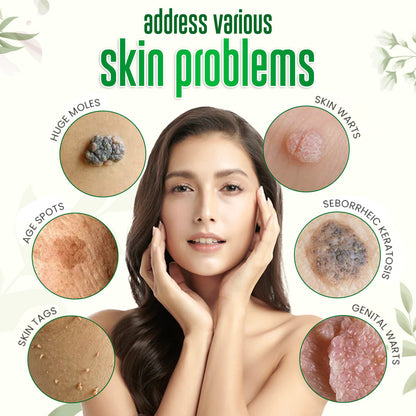 ✅Official Store: ODALIT™ Nature Erase Instant Mole & Spot Removal Gel