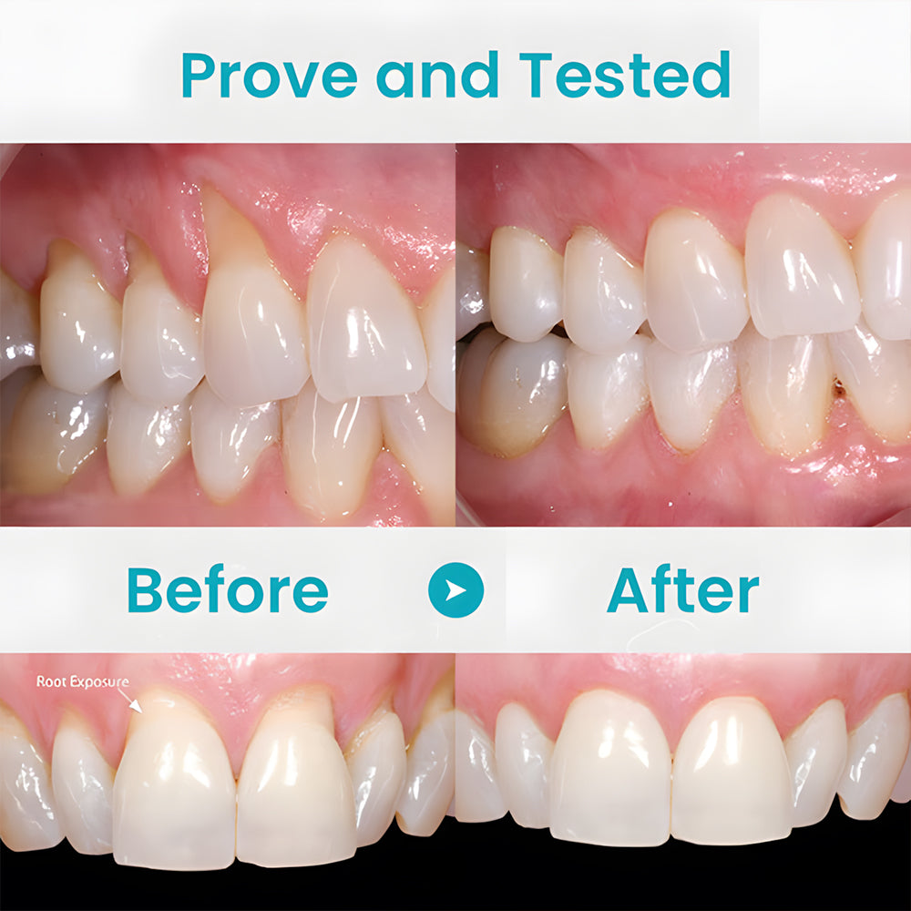 Odeiun™ Gum Repair Treatment Ampoules