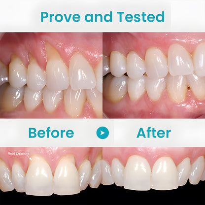 Odeiun™ Gum Repair Treatment Ampoules
