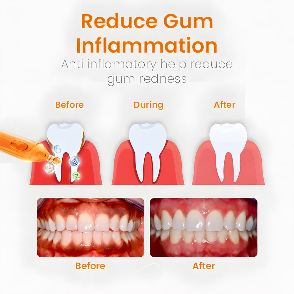 Odeiun™ Gum Repair Treatment Ampoules