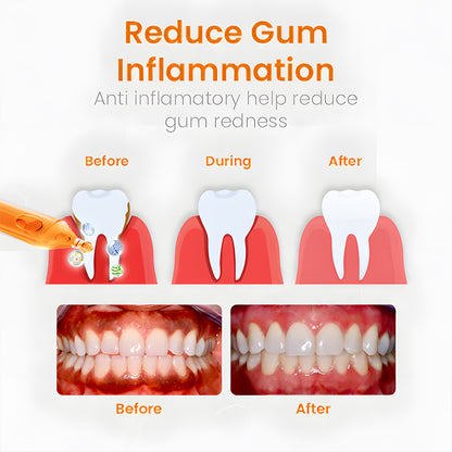 Odeiun™ Gum Repair Treatment Ampoules