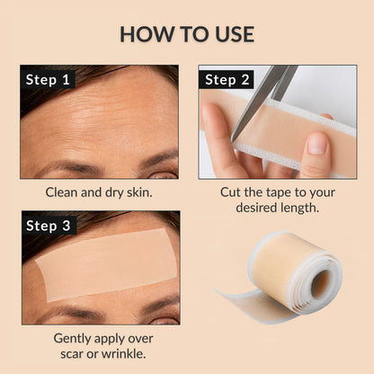 Negusy™ Silicone Scar Tape