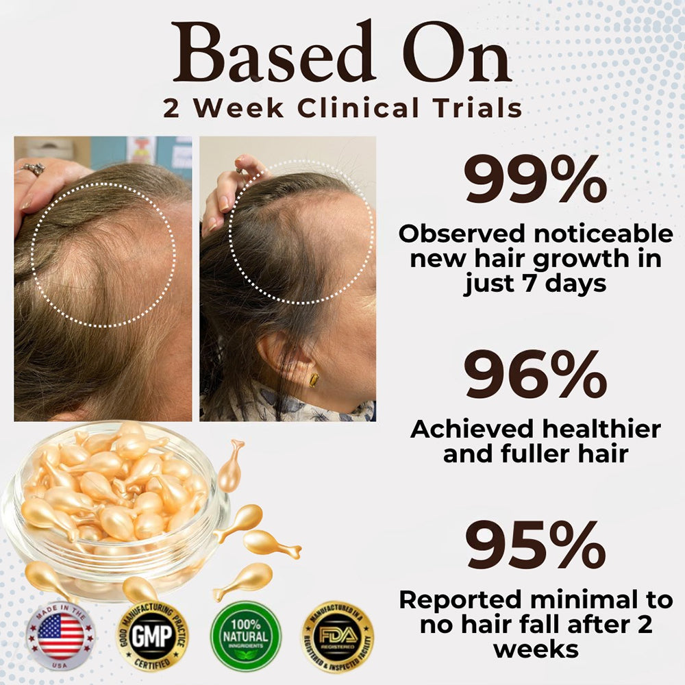 Odeiun™ Hair Renewal Capsules: Nourish for Thicker, Fuller Hair ✨