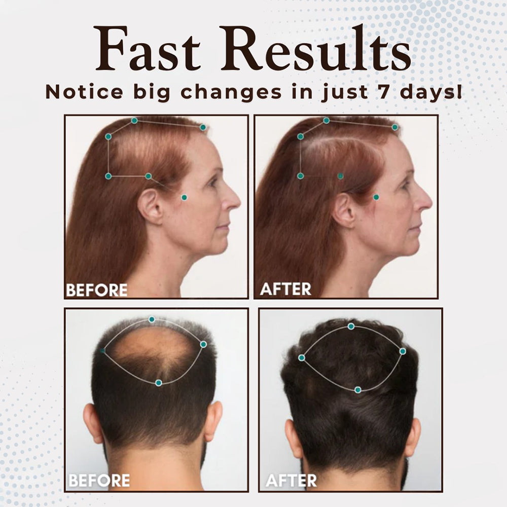 Odeiun™ Hair Renewal Capsules: Nourish for Thicker, Fuller Hair ✨