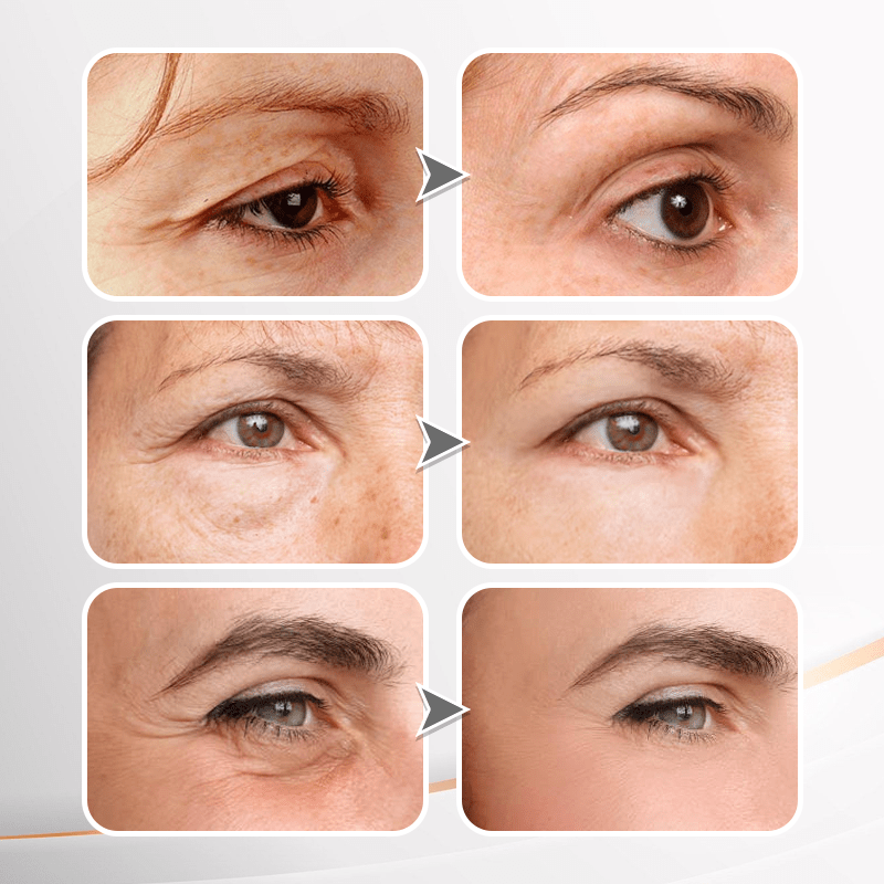 Seurico™ Youth Radiance Firming Eye Cream