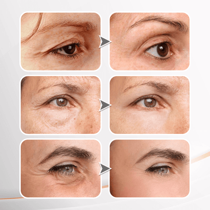 Seurico™ Youth Radiance Firming Eye Cream
